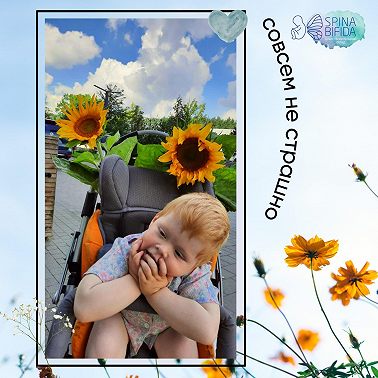 Как диагностируется spina bifida?