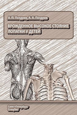 Врожденное высокое стояние лопатки у детей