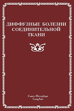 Диффузные болезни соединительной ткани